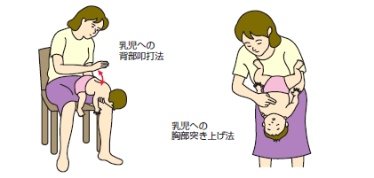 乳児への背部即打法と乳児への胸部突き上げ法