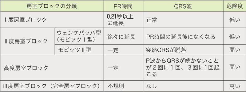 房室ブロックの分類表