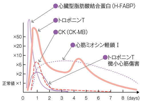 血液生化学的心筋マーカーグラフ