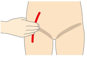 大腿動脈