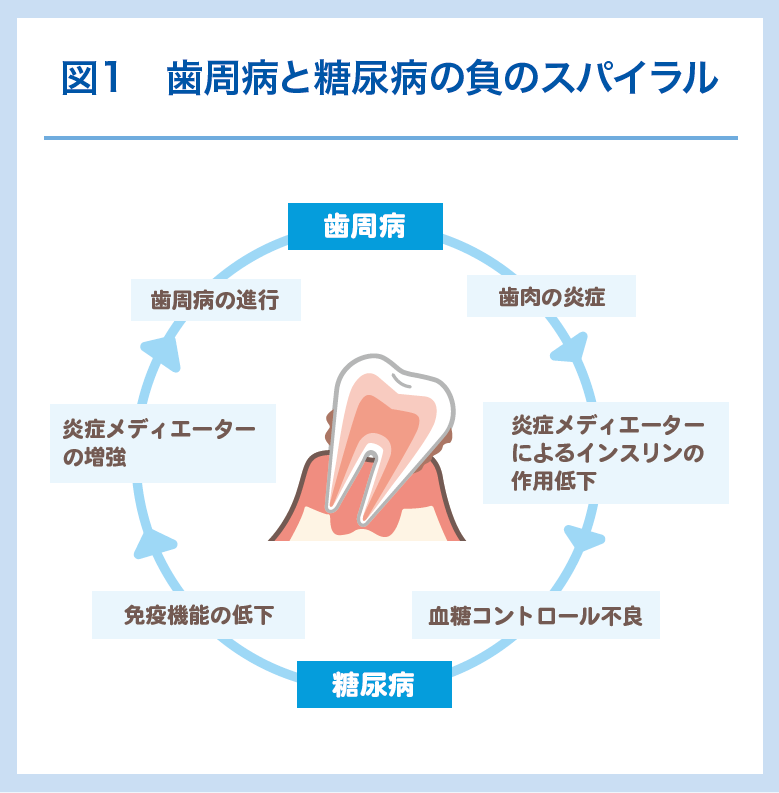 図1 歯周病と糖尿病の負のスパイラル