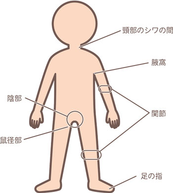 洗い残しが多い部位の図