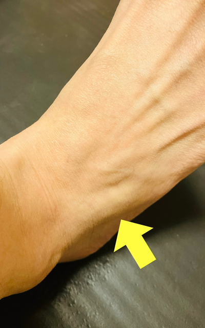 短趾伸筋（背屈時）