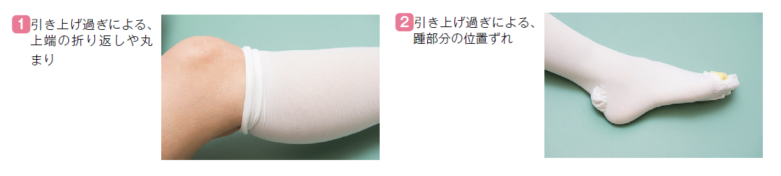 弾性ストッキングの間違った装着例_01