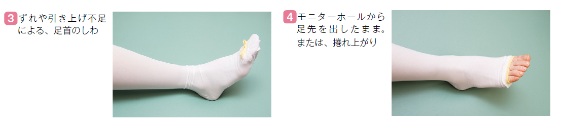 弾性ストッキングの間違った装着例_02