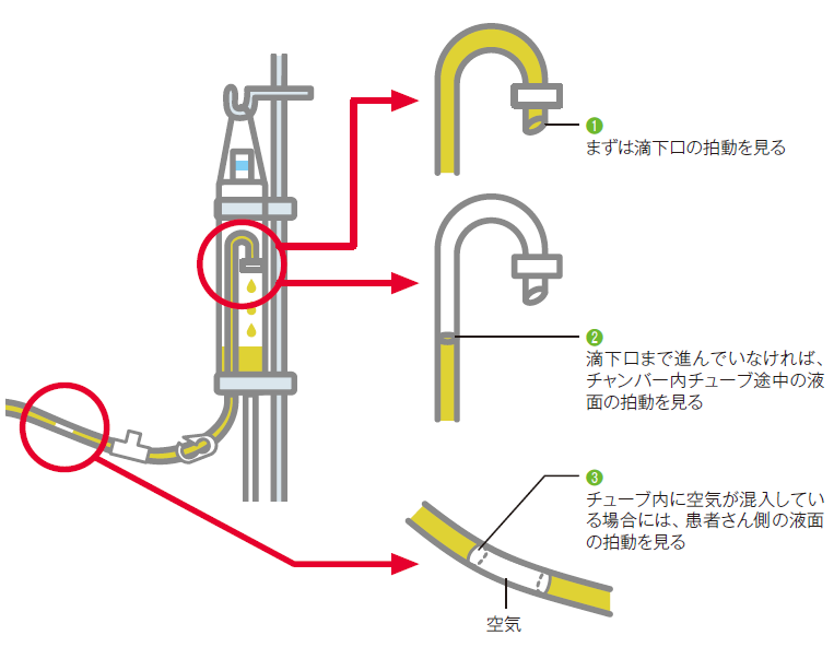 拍動のチェック